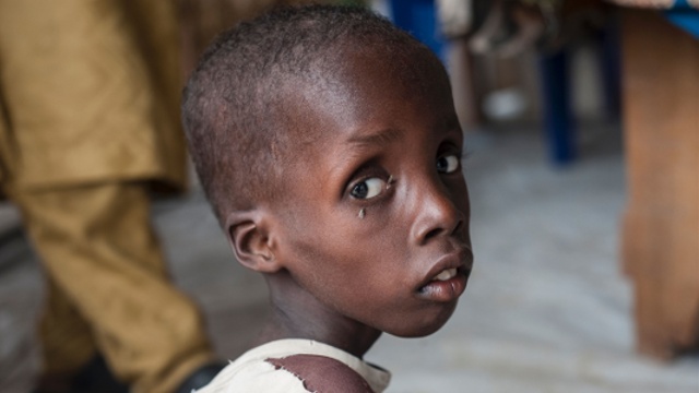 «Врачи без границ»: нигерийцам угрожает голод