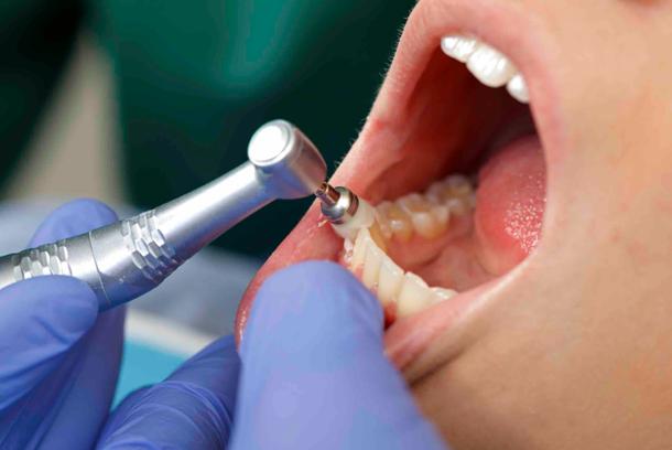 Дополнительные услуги при имплантации зубов