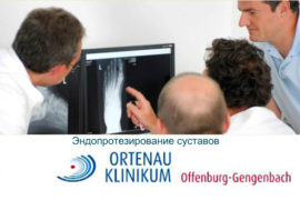 Замена суставов в немецкой клинике Ortenau