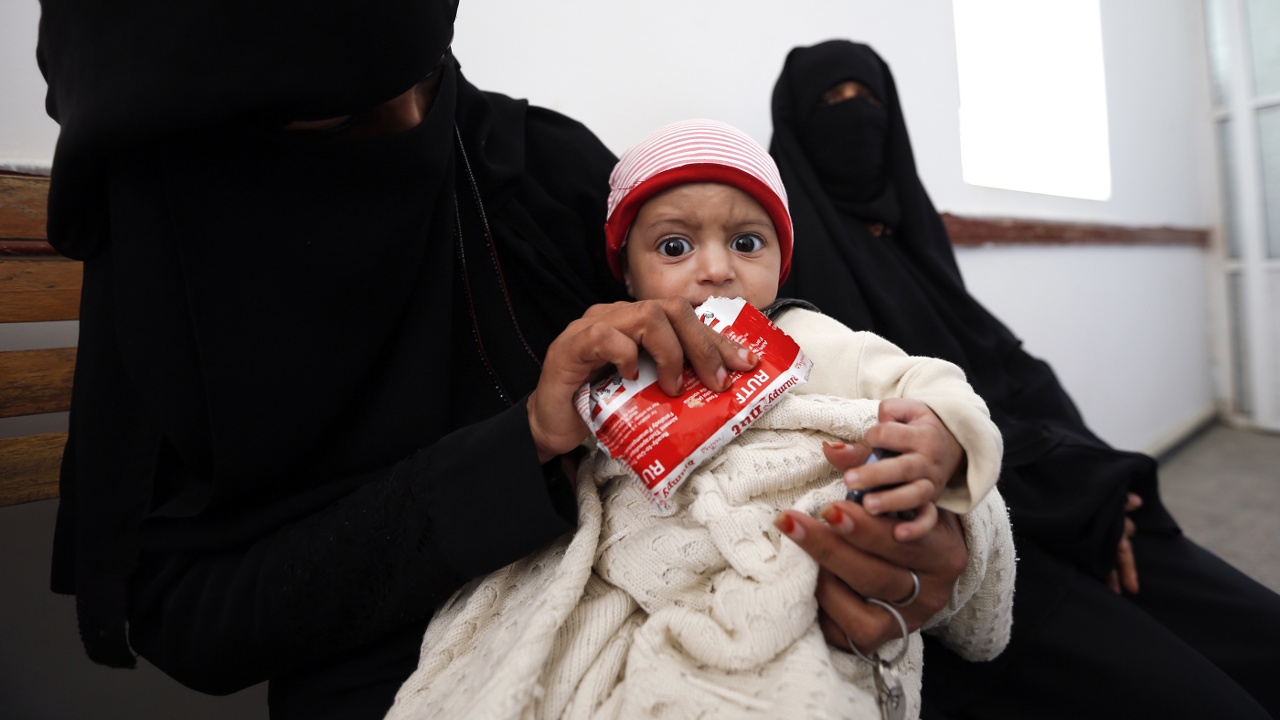 ЮНИСЕФ: тысячи детей в Йемене страдают от недоедания