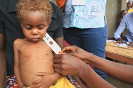 400 тысячам детей ДР Конго угрожает голодная смерть