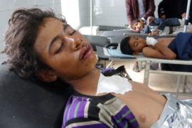 Авиаудар в Йемене: погибли 20 гостей деревенской свадьбы