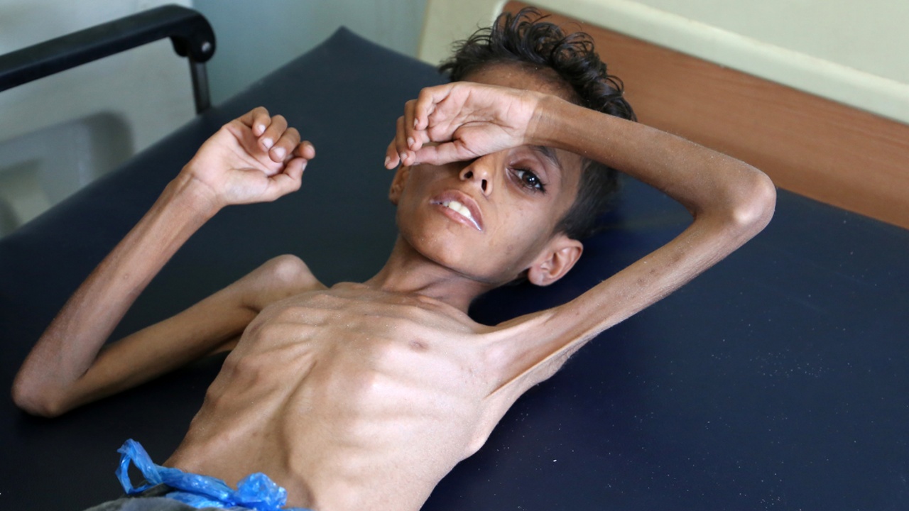 ЮНИСЕФ: в Йемене каждые десять минут умирает маленький ребёнок