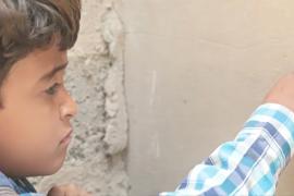 8-летний йеменец почти ослеп в результате авиаудара