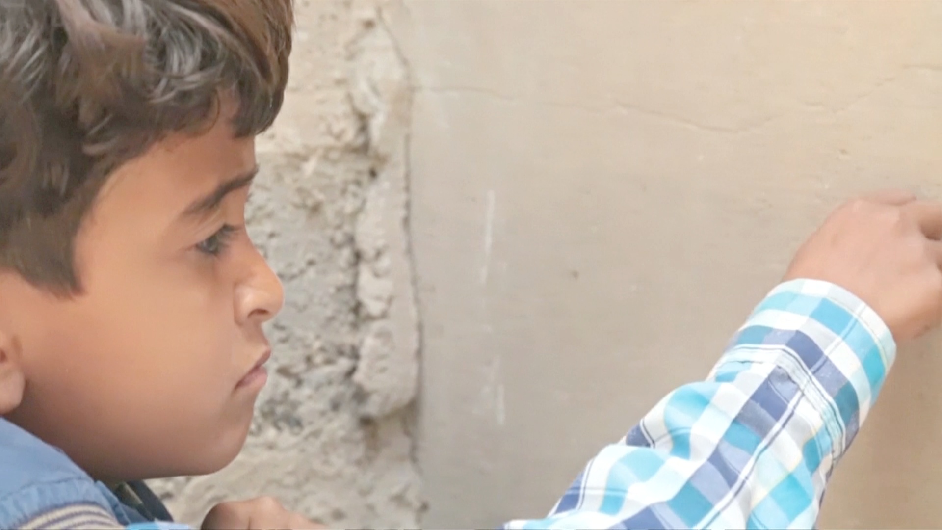 8-летний йеменец почти ослеп в результате авиаудара