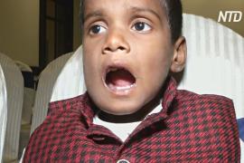 У семилетнего индийца выросло более 500 зубов