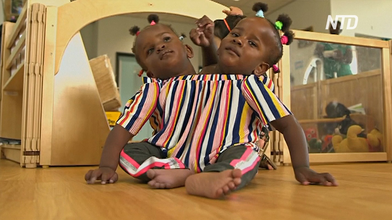 Сиамские близнецы из Сенегала начинают новую жизнь в Великобритании