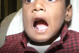 Удивительная Индия: 526 зубов в челюсти мальчика и 1,5 кг украшений в желудке женщины