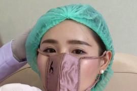 Мини-маски для косметологических процедур делают лицо более открытым