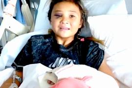 11-летняя скейтбордистка поломала череп и руку, но всё ещё собирается на Олимпиаду