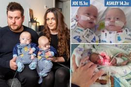 Новорождённые близнецы размером с ладонь выжили