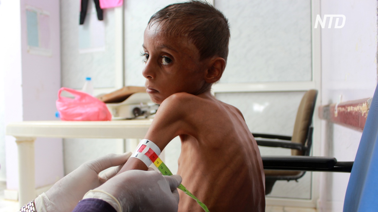 Недоедающим йеменским детям угрожает голод