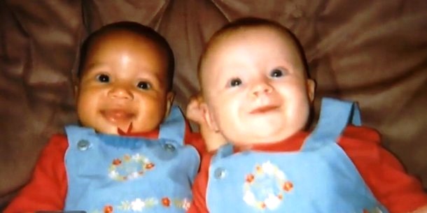 Как выглядят сёстры-близнецы с разным цветом кожи через 20 лет