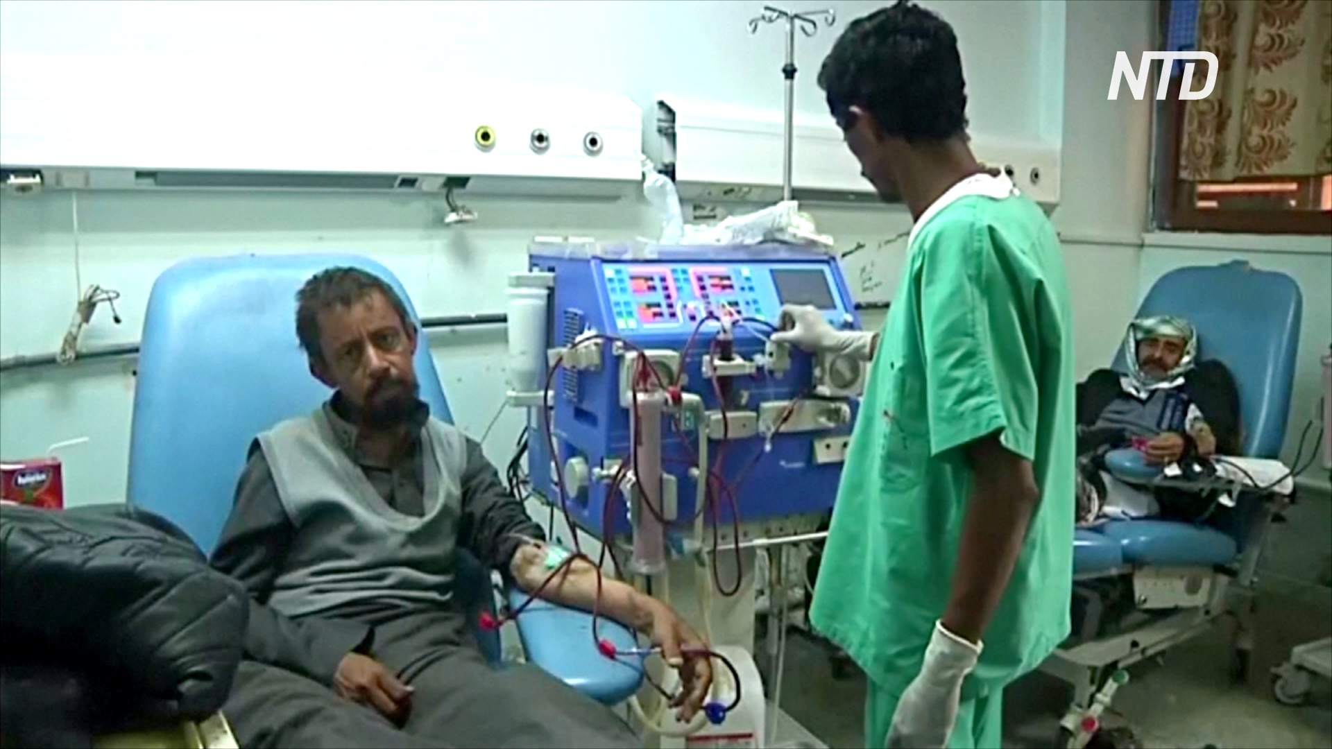 В йеменских больницах аппараты для диализа вращают вручную из-за отключения света