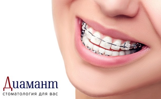 «Диамант» — платная стоматология в Москве
