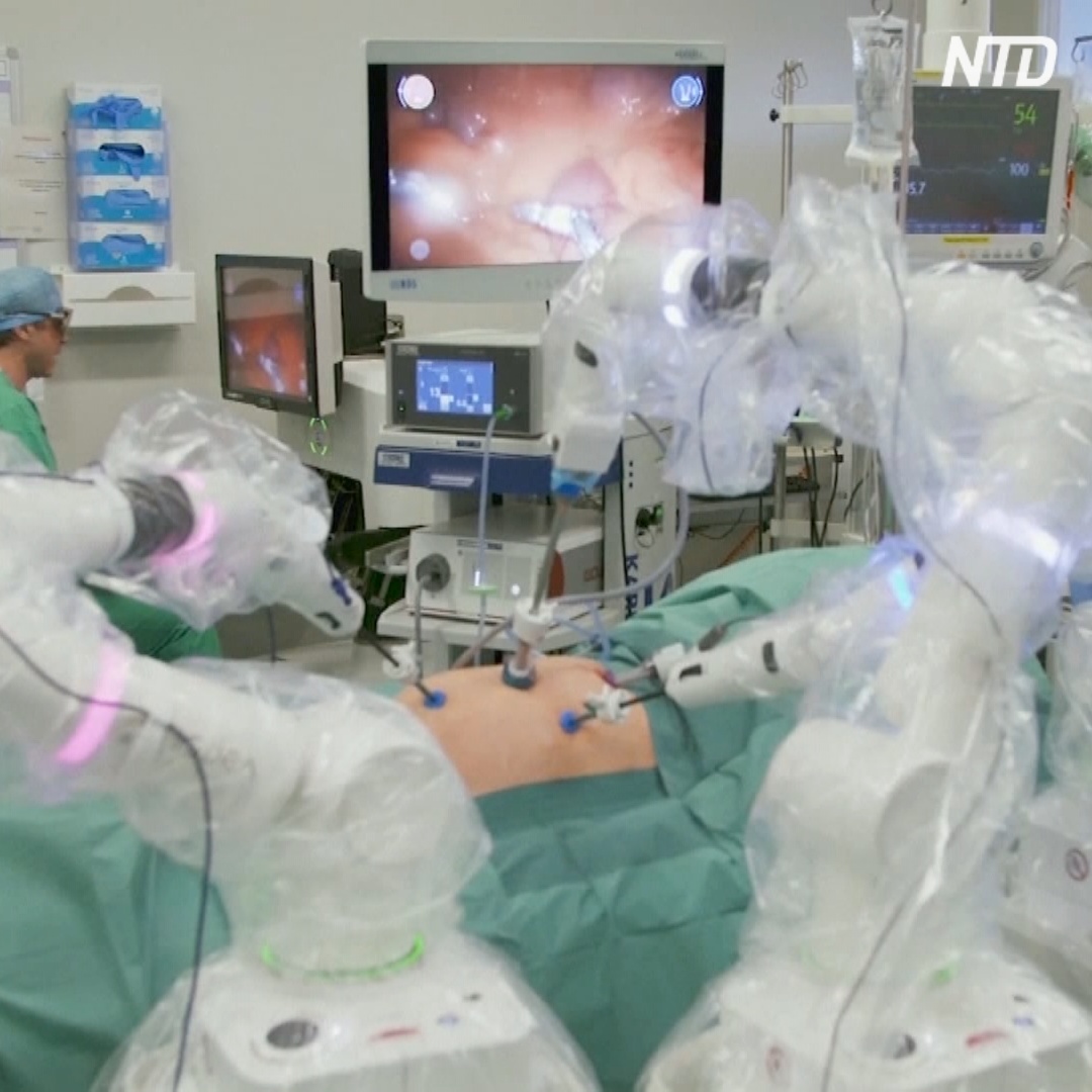 1000 операций робота-хирурга Versius: без разрезов и осложнений
