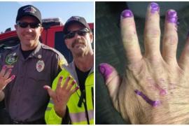 Зачем пожарные попросили накрасить им ногти