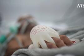 «Прикосновение любви»: как перчатки с тёплой водой помогают пациентам с COVID-19