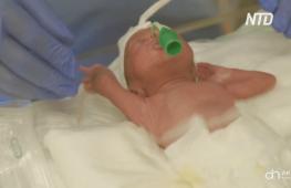 Африканка родила девять близнецов