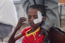 ООН: 350 тысяч жителей эфиопского региона Тыграй голодают из-за вооружённого конфликта