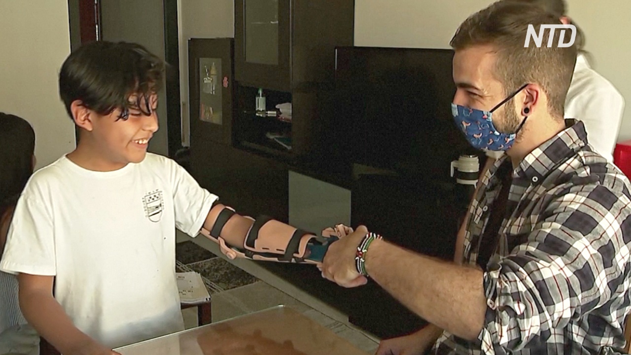 Испанский изобретатель делает 3D-печатные протезы и дарит их инвалидам