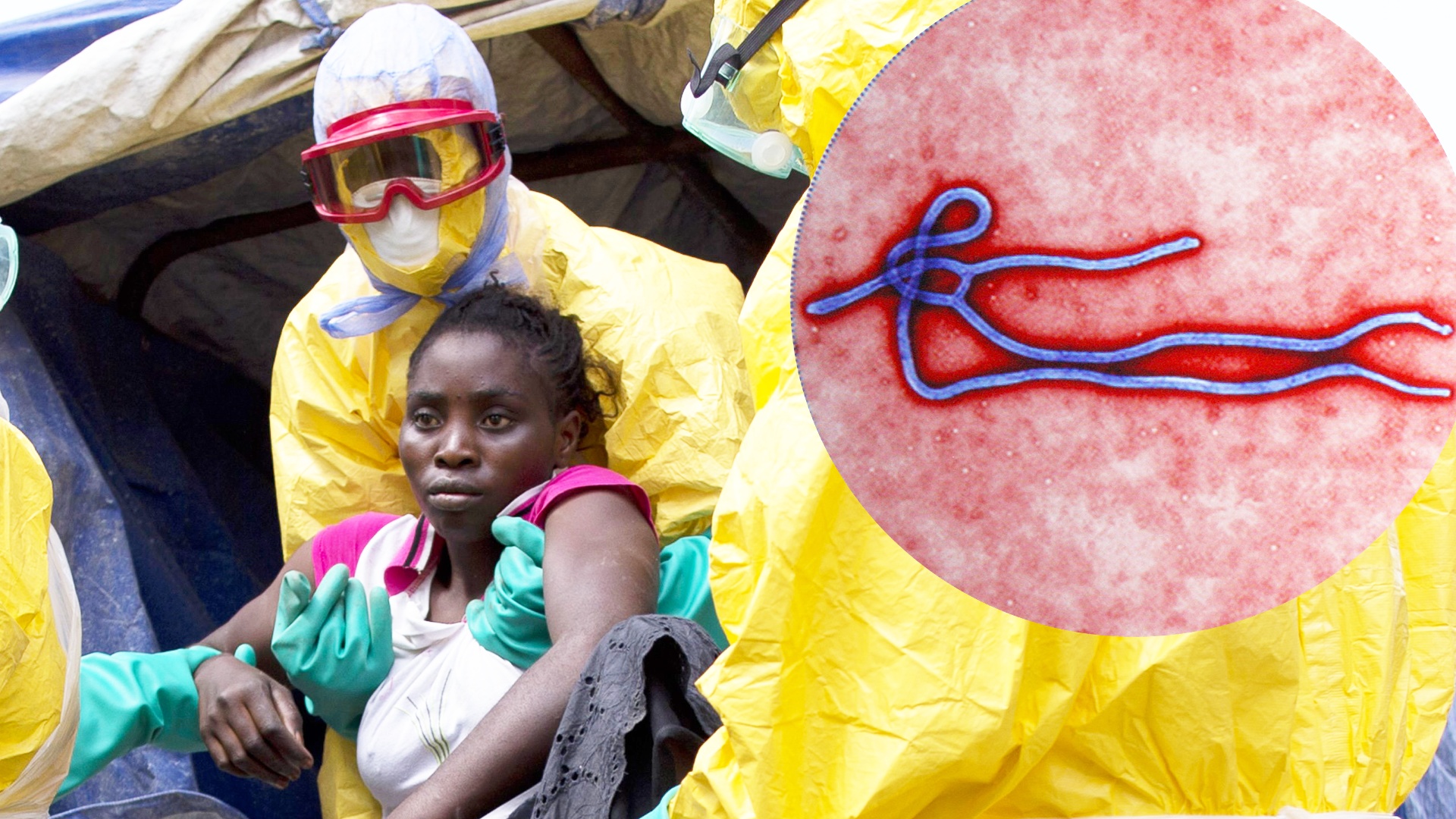 В Западной Африке – первый случай заболевания опасной лихорадкой Марбург