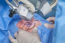 Выполнить операцию катаракты в надёжном центре