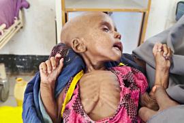 Засуха в Сомали набирает обороты: начали гибнуть дети