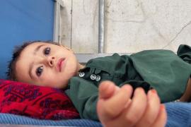 В Афганистане стало вдвое больше детей, страдающих от острого недоедания