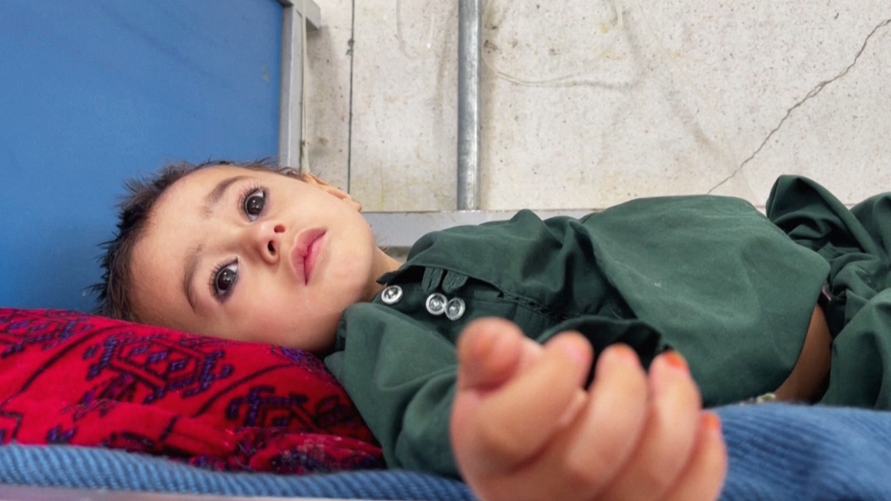 В Афганистане стало вдвое больше детей, страдающих от острого недоедания