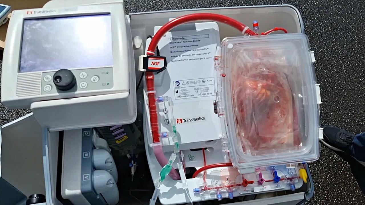 Как «сердце в коробке» помогает спасать пациентов, нуждающихся в трансплантации