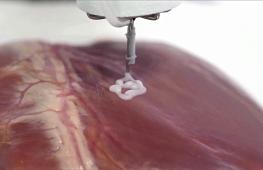 3D-принтер, печатающий прямо внутри тела человека, поможет удалять раковые опухоли