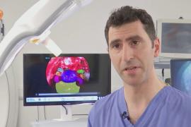 Искусственный интеллект поможет безопаснее проводить операции на головном мозге
