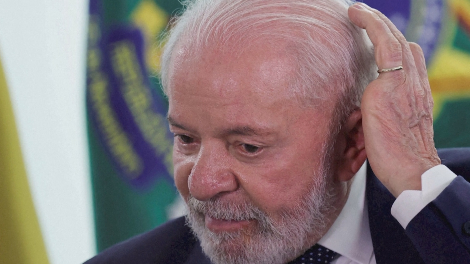 Президенту Бразилии сделали срочную операцию из-за внутричерепного кровоизлияния