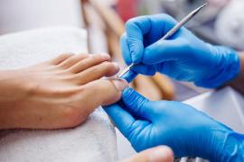 Как ухаживать за вросшим ногтем: советы от подолога