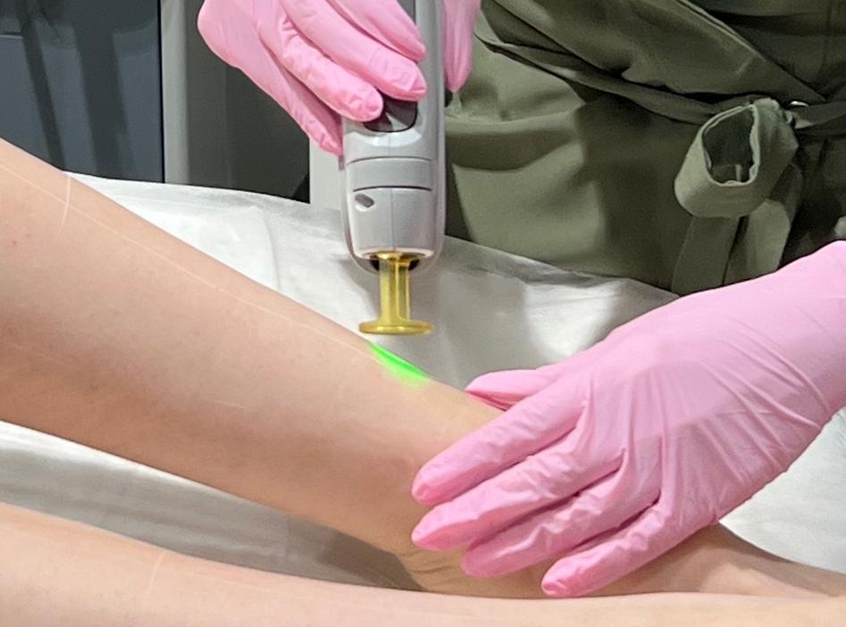 Александритовый лазер: современный взгляд на лазерную эпиляцию Александритовый лазер: современный взгляд на лазерную эпиляцию