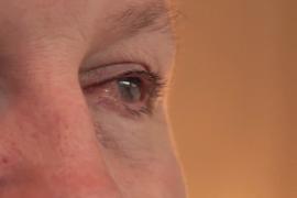 Трансплантат плаценты помогает вернуть зрение мужчине, которого облили кислотой