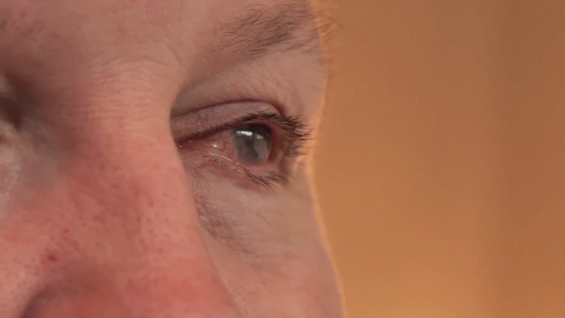 Трансплантат плаценты помогает вернуть зрение мужчине, которого облили кислотой Трансплантат плаценты помогает вернуть зрение мужчине, которого облили кислотой