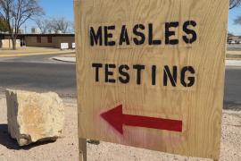 В США впервые за 10 лет зарегистрировали смерть от кори