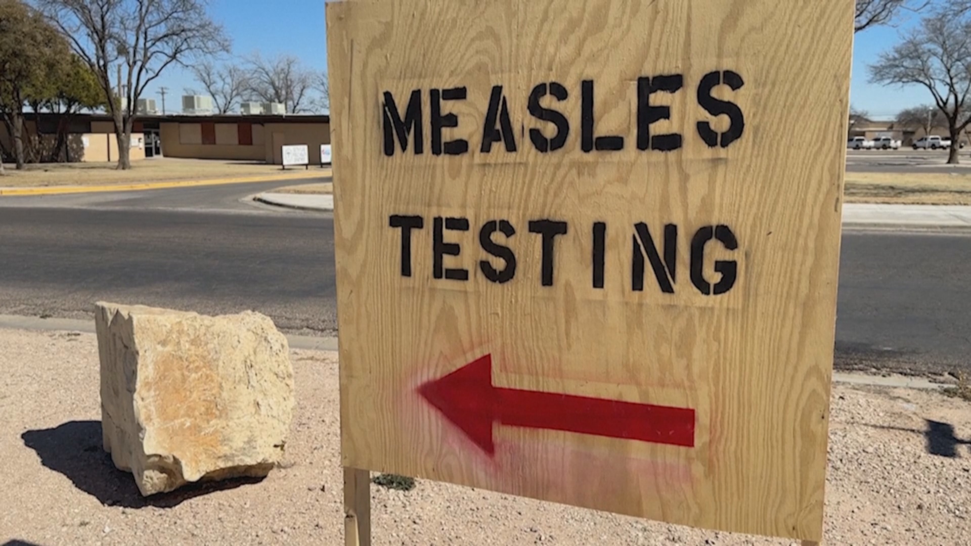 В США впервые за 10 лет зарегистрировали смерть от кори В США впервые за 10 лет зарегистрировали смерть от кори