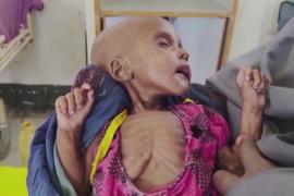 ВПП: в Сомали голодающих может стать на миллион больше