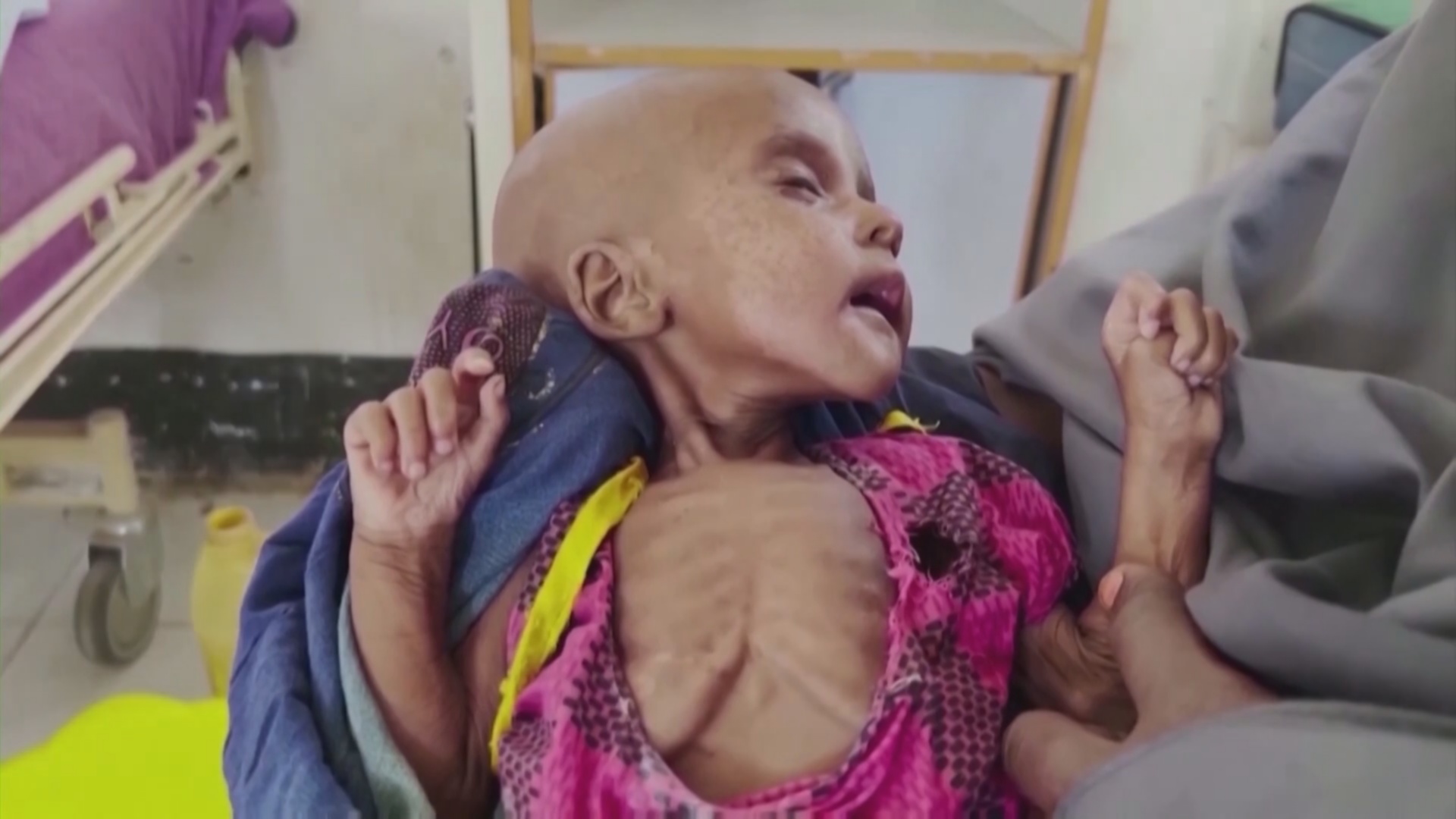 ВПП: в Сомали голодающих может стать на миллион больше