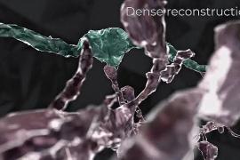 Как исследование мозга мыши поможет лечить болезнь Альцгеймера