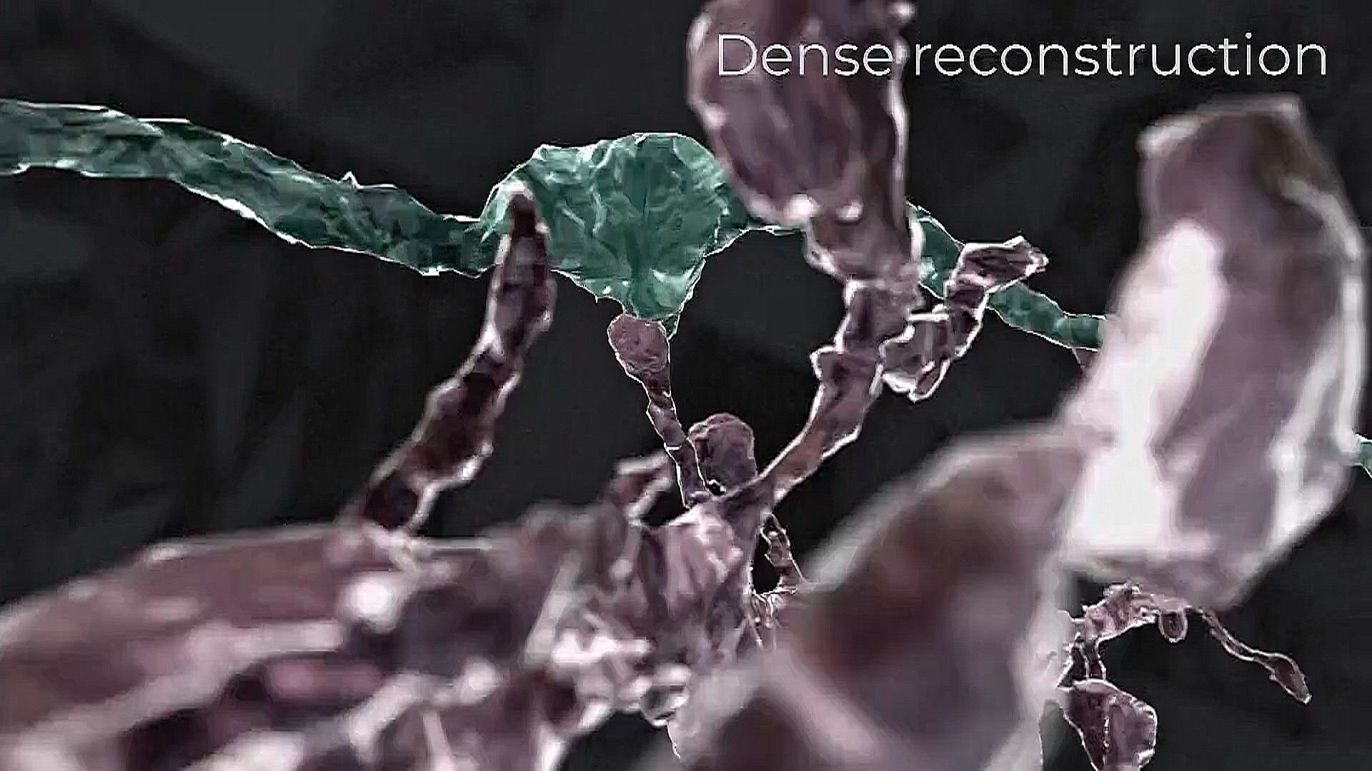 Как исследование мозга мыши поможет лечить болезнь Альцгеймера