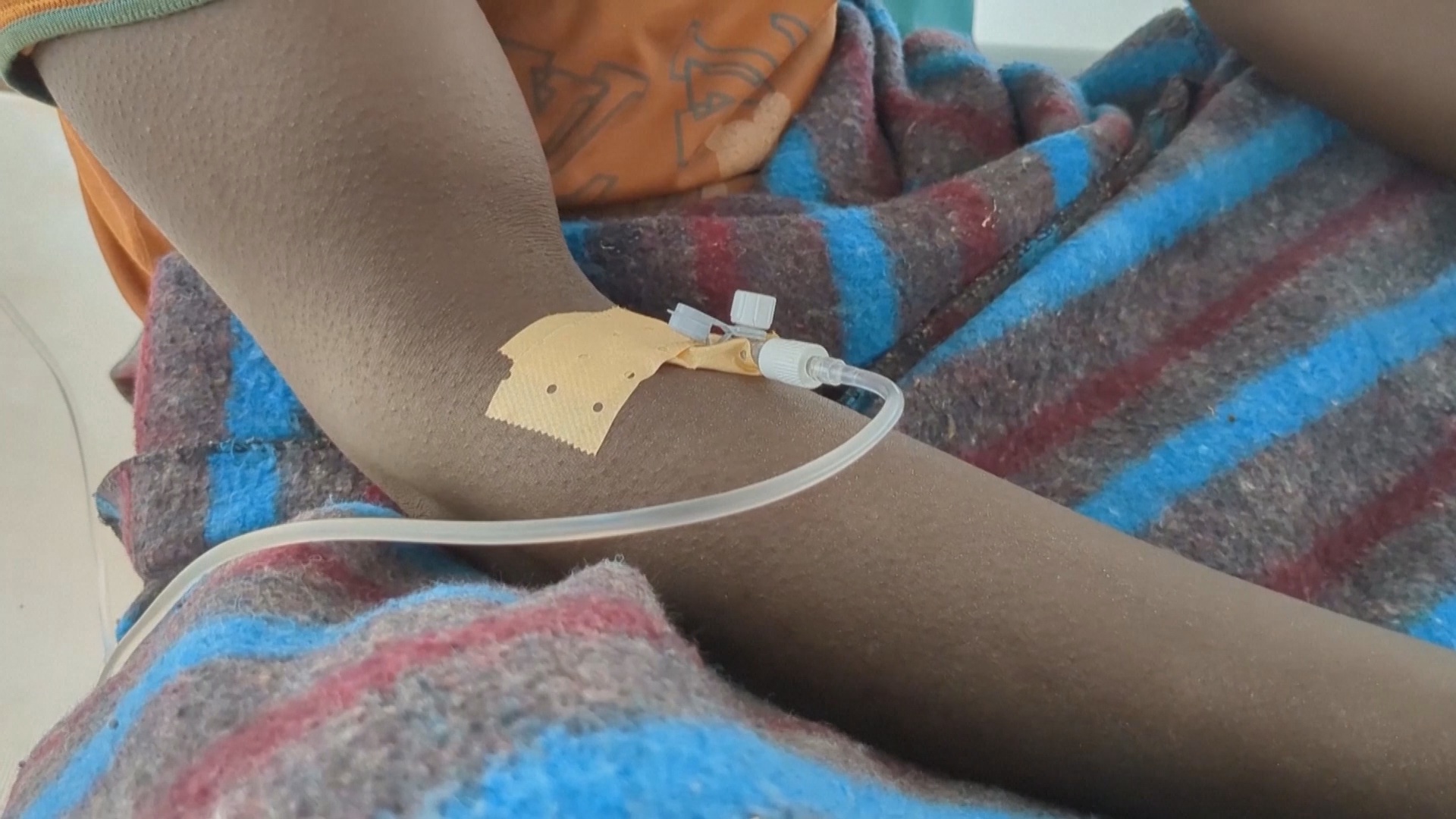 Эпидемия холеры на золотом руднике в ДР Конго: 600 человек умерли