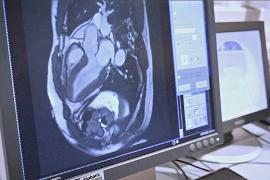 Британские учёные просканировали 100 тысяч тел для медицины