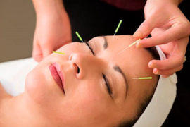 Иглотерапия: древняя практика в современном медицинском контексте