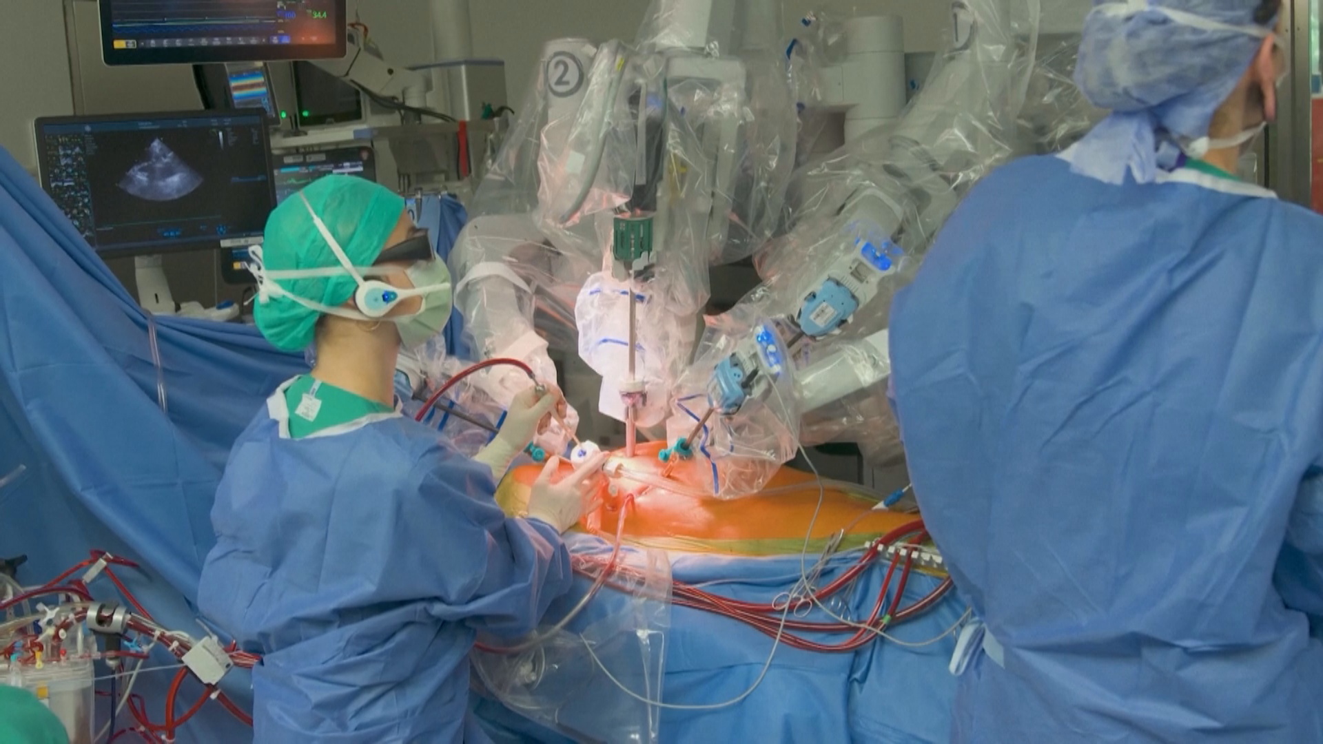 Кардиоцентр в Берлине готовится к внедрению нового поколения роботов-хирургов Кардиоцентр в Берлине готовится к внедрению нового поколения роботов-хирургов