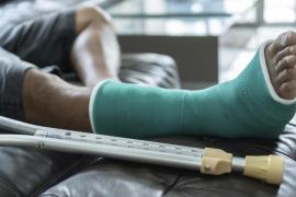 Восстановление после перелома ноги: от гипса до полноценной ходьбы