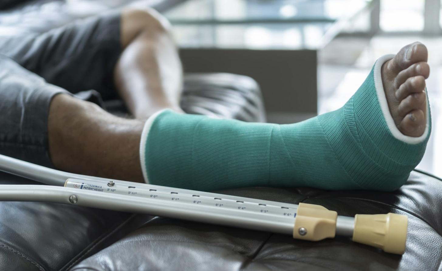 Восстановление после перелома ноги: от гипса до полноценной ходьбы
